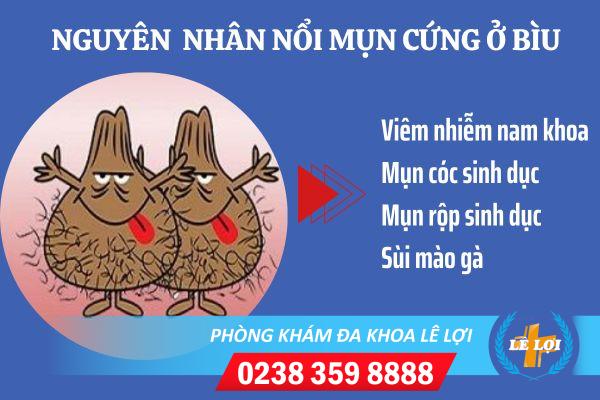 Nổi mụn cứng ở bìu: Nguyên nhân và cách điều trị