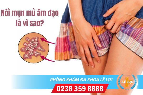 Nổi mụn mủ âm đạo có sao không? điều trị thế nào?