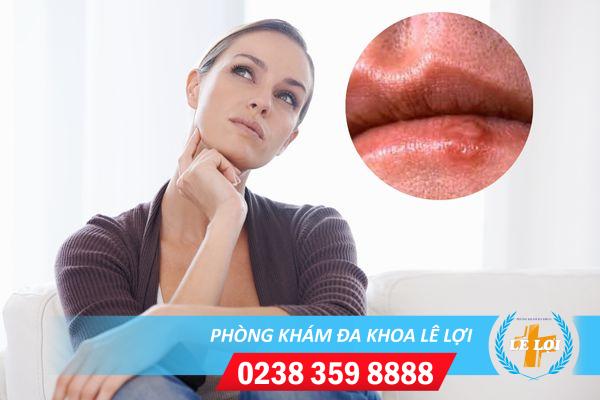 Nổi mụn trắng ở môi là bị gì nguy hiểm không?