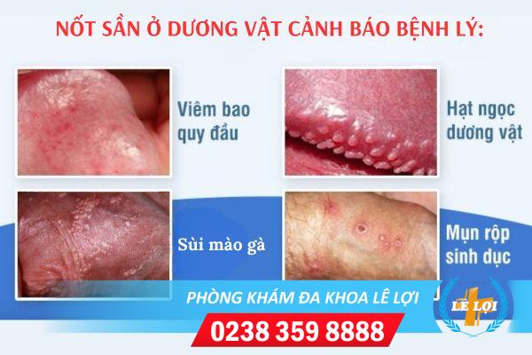 not-san-o-cau-nho-nguy-hiem-khong-1