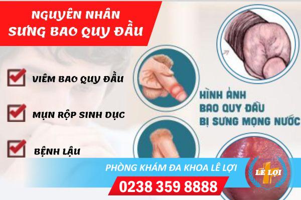 quy-dau-sung-mong-nuoc-la-bi-benh-gi-1