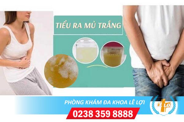 Tiểu ra mủ trắng là dấu hiệu bệnh gì?