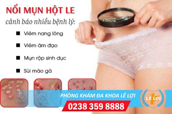 Vì sao nổi mụn mủ hột le và cách điều trị