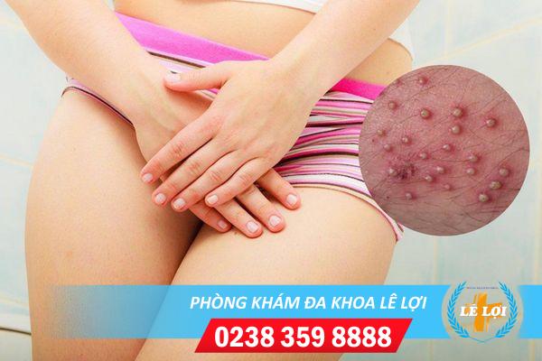 Nổi hạt trắng ở hột le là bệnh gì?