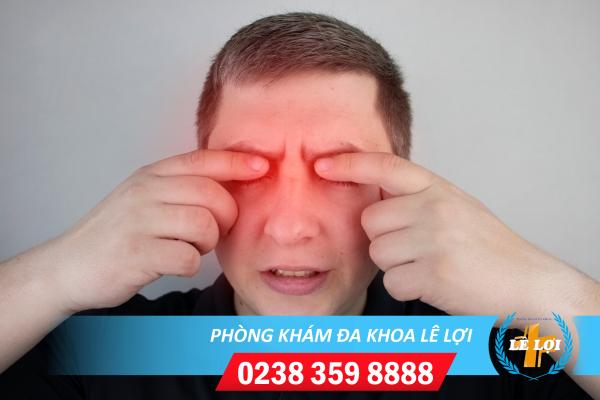 Dấu hiệu bệnh lậu ở mắt và cách chữa trị