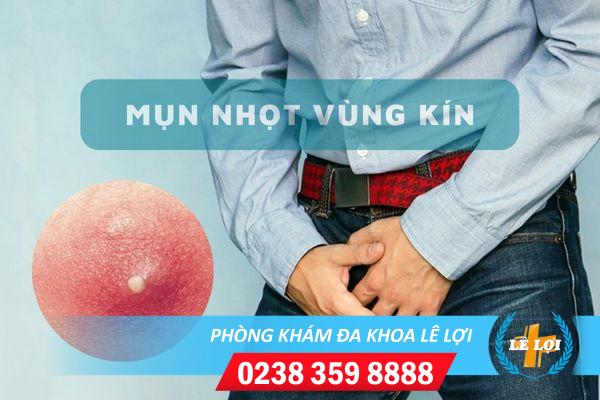 Cách điều trị nổi mụn nhọt ở vùng kín nam hiệu quả