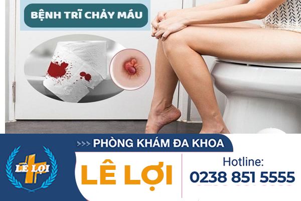 Bệnh trĩ chảy máu nguy hiểm không phải làm sao?