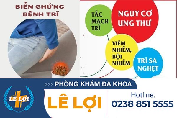 Mổ trĩ – chi phí mổ trĩ nghệ an bao nhiêu?