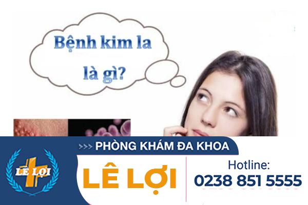 Dấu hiệu bệnh kim la và cách điều trị