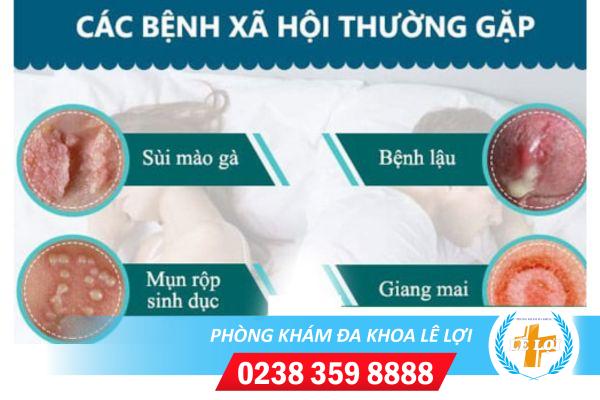 benh-xa-hoi-4