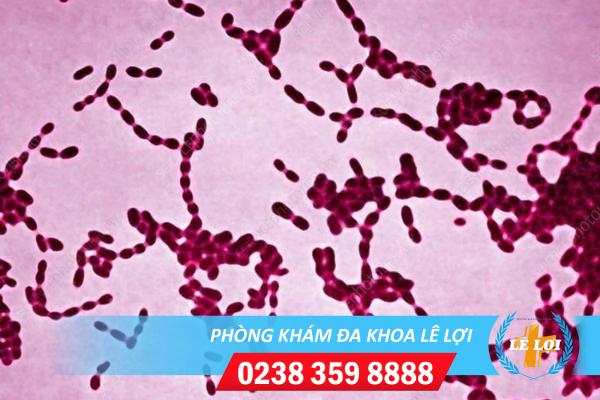 Nguyên nhân hạ cam mềm và cách điều trị hiệu quả
