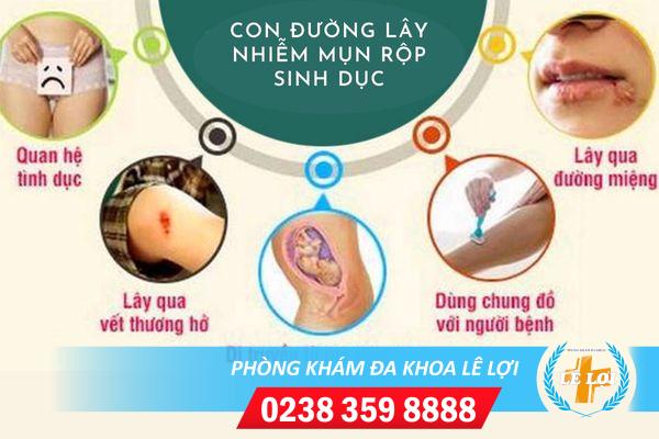 Nguyên nhân mụn rộp sinh dục ở nam và nữ