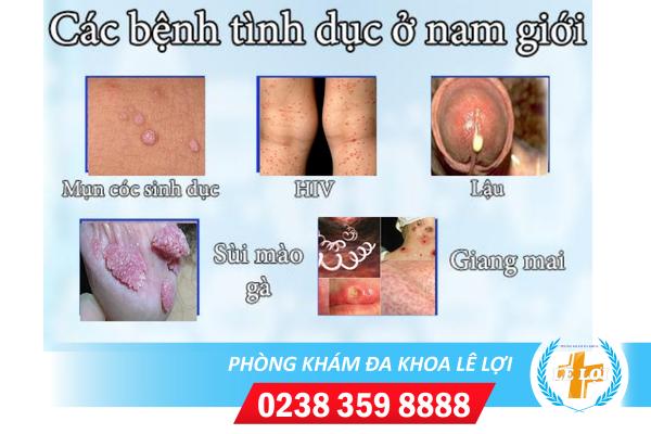 benh-tinh-duc-do-quan-he-gai-mai-dam