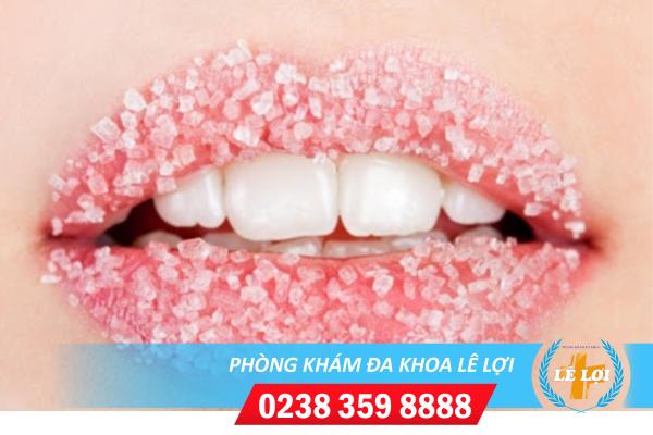 Cách chữa sùi mào gà miệng hiệu quả