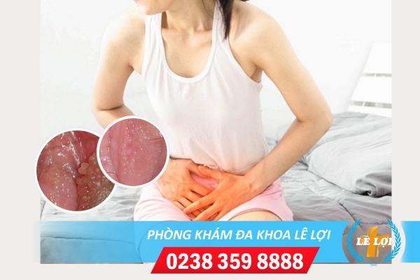 Cách chữa chuỗi hạt ngọc âm vật hiệu quả