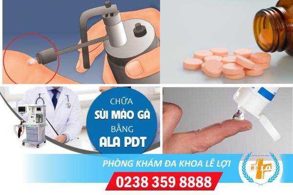Đốt sùi mào gà có hết không?