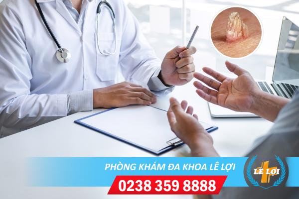 Khám sùi mào gà ở đâu hiệu quả uy tín?