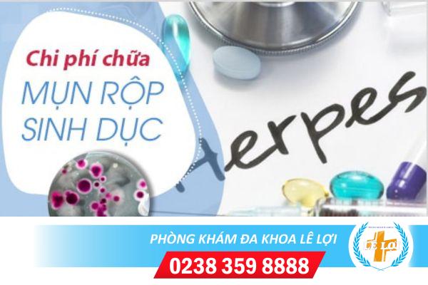 Chi phí khám chữa mụn rộp sinh dục hiện nay
