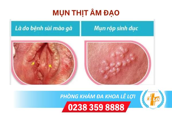 mun-thit-am-dao (2)