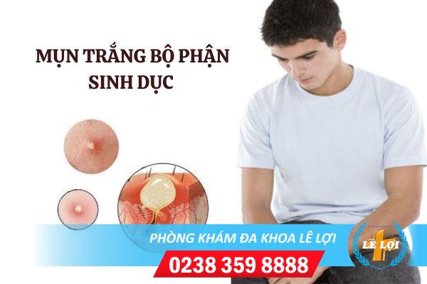 Nổi mụn trắng bộ phận sinh dục nam là bị bệnh gì?