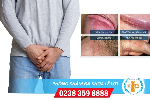 Những nguyên nhân gây nổi mụn dương vật