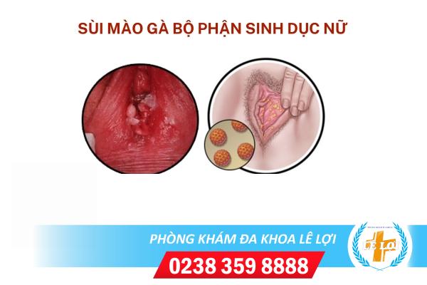 sui-mao-ga-bo-phan-sinh-duc