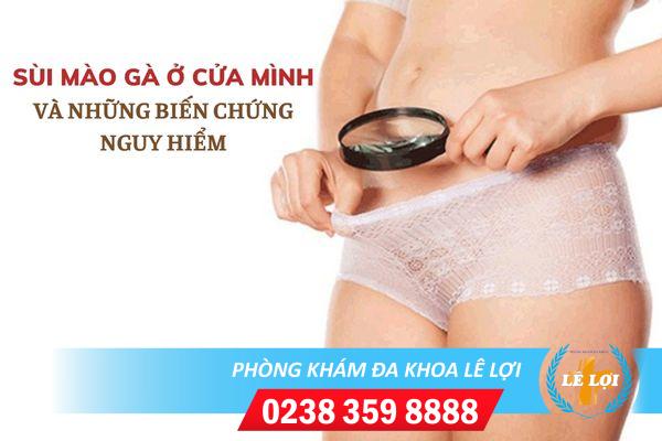Sùi mào gà cửa mình và những biến chứng nguy hiểm