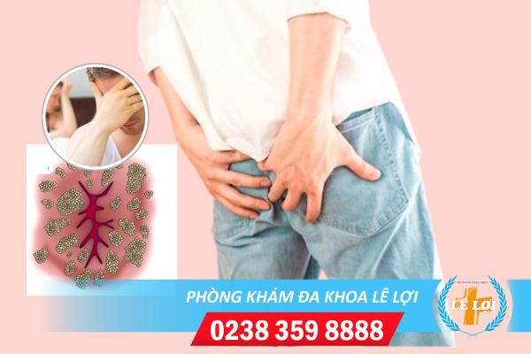 Nguyên nhân sùi mào gà ở hậu môn
