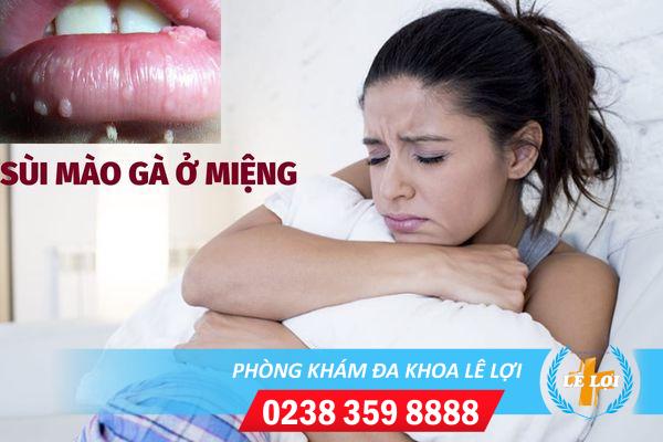 Những biểu hiện sùi mào gà miệng giai đoạn đầu