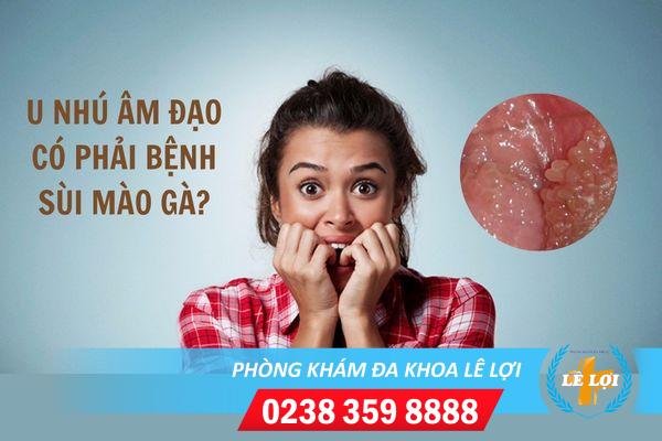 U nhú âm đạo có phải là bệnh sùi mào gà?