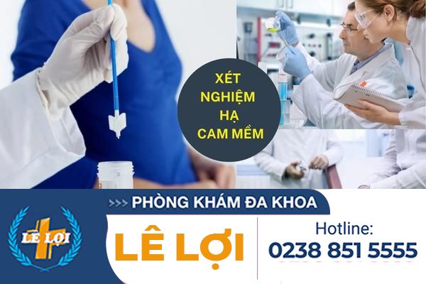 Những điều cần biết về xét nghiệm hạ cam mềm