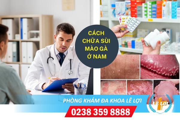 Cách chữa sùi mào gà ở nam hiệu quả