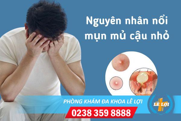 Nổi mụn mủ cậu nhỏ có sao không?