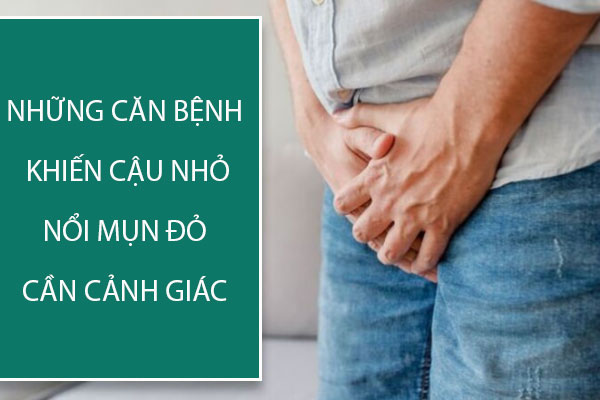 Những căn bệnh khiến cậu nhỏ nổi mụn đỏ cần cảnh giác
