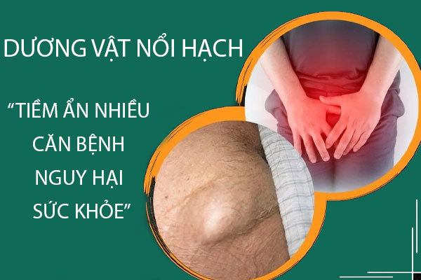 Dương vật nổi hạch tiềm ẩn nhiều căn bệnh nguy hại sức khỏe