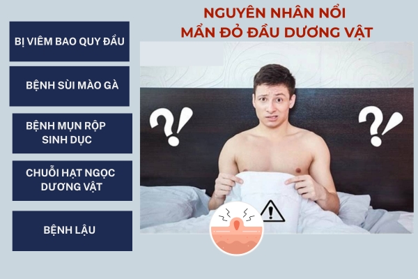 Mẩn đỏ đầu dương vật phải làm sao?