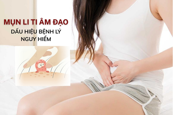 5 nguyên nhân gây nổi mụn li ti âm đạo chị em cần cảnh giác