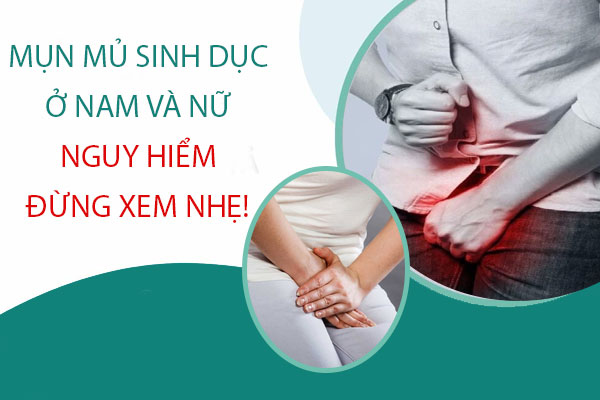 Mụn mủ sinh dục ở nam và nữ nguy hiểm đừng xem nhẹ