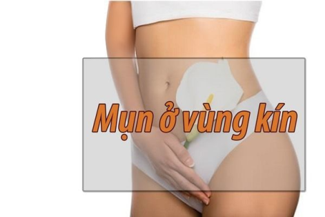 Mụn nhọt vùng kín nữ là dấu hiệu bệnh xã hội?