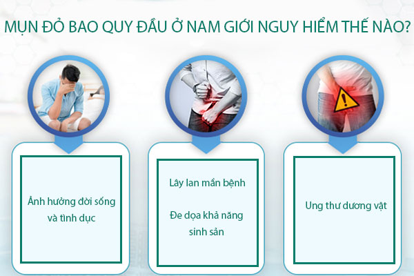 Mụn đỏ bao quy đầu cảnh báo 4 loại bệnh nguy hiểm ở nam giới