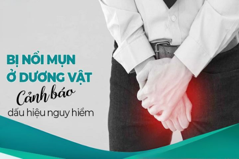 Chim nổi mụn là dấu hiệu bệnh gì?